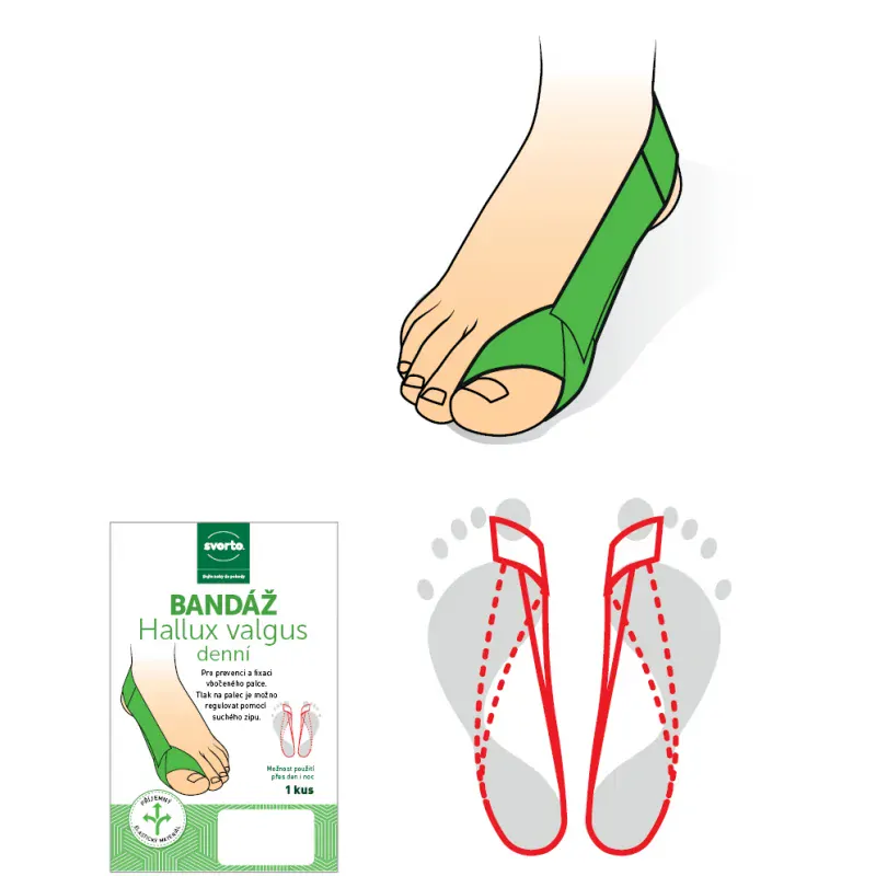 Bandáž Hallux Valgus denní Svorto